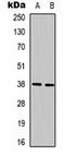 DNA repair protein XRCC4 antibody, orb323202, Biorbyt, Western Blot image 