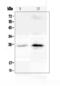 C-Reactive Protein antibody, A00249-4, Boster Biological Technology, Western Blot image 