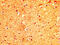 Myosin VA antibody, CSB-PA857430LA01HU, Cusabio, Immunohistochemistry frozen image 