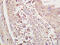Dual specificity protein kinase TTK antibody, GTX51836, GeneTex, Immunohistochemistry paraffin image 