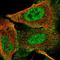 Zinc finger protein GLI1 antibody, HPA065172, Atlas Antibodies, Immunofluorescence image 