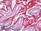 Periostin antibody, LS-B10443, Lifespan Biosciences, Immunohistochemistry frozen image 