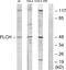 Glycerol-3-Phosphate Acyltransferase 3 antibody, A30503, Boster Biological Technology, Western Blot image 