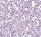 TBC1 Domain Family Member 10C antibody, A11412, Boster Biological Technology, Immunohistochemistry frozen image 