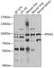 EPH Receptor A1 antibody, GTX55605, GeneTex, Western Blot image 
