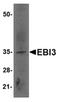 Succinate Dehydrogenase Complex Subunit D antibody, orb6907, Biorbyt, Western Blot image 