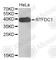 Replication Termination Factor 2 antibody, A4742, ABclonal Technology, Western Blot image 