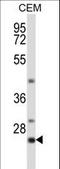 Lck Interacting Transmembrane Adaptor 1 antibody, LS-C165777, Lifespan Biosciences, Western Blot image 