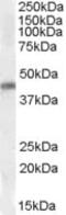 Homeobox protein Nkx-2.5 antibody, ab106923, Abcam, Western Blot image 