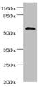 Diphthamide Biosynthesis 2 antibody, CSB-PA859031LA01HU, Cusabio, Western Blot image 