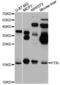 Pleiotrophin antibody, LS-C749069, Lifespan Biosciences, Western Blot image 