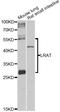 Lecithin Retinol Acyltransferase antibody, LS-C748315, Lifespan Biosciences, Western Blot image 