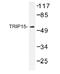 COP9 Signalosome Subunit 2 antibody, AP01234PU-N, Origene, Western Blot image 