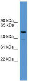 Synaptotagmin-2 antibody, TA342627, Origene, Western Blot image 