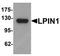 Phosphatidate phosphatase LPIN1 antibody, TA319846, Origene, Western Blot image 