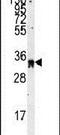 Exosome Component 8 antibody, PA5-12378, Invitrogen Antibodies, Western Blot image 