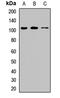 Protein CIP2A antibody, LS-C668605, Lifespan Biosciences, Western Blot image 