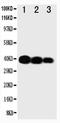 Interleukin 12B antibody, PA1468, Boster Biological Technology, Western Blot image 