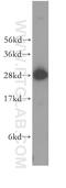 B Cell Receptor Associated Protein 29 antibody, 15796-1-AP, Proteintech Group, Western Blot image 