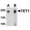 Tet Methylcytosine Dioxygenase 1 antibody, TA349033, Origene, Western Blot image 