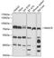 3-Hydroxy-3-Methylglutaryl-CoA Reductase antibody, 16-554, ProSci, Western Blot image 