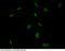 Poly(ADP-Ribose) Polymerase 1 antibody, 100984-T46, Sino Biological, Immunohistochemistry paraffin image 