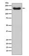 Complement Factor H antibody, M00562, Boster Biological Technology, Western Blot image 