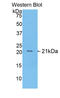 Fibrinogen Alpha Chain antibody, LS-C304837, Lifespan Biosciences, Western Blot image 
