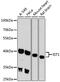 IST1 homolog antibody, 23-853, ProSci, Western Blot image 