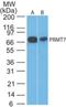 Protein Arginine Methyltransferase 7 antibody, NB100-56400, Novus Biologicals, Western Blot image 