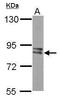 Phosphofructokinase, Muscle antibody, TA308655, Origene, Western Blot image 