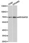 Rho GTPase Activating Protein 25 antibody, TA327008, Origene, Western Blot image 