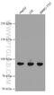 Phospholipase A2 Group IVD antibody, 66752-1-Ig, Proteintech Group, Western Blot image 