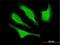 Cyclin Dependent Kinase 5 Regulatory Subunit 1 antibody, H00008851-M01, Novus Biologicals, Immunocytochemistry image 
