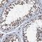 Katanin Catalytic Subunit A1 Like 2 antibody, HPA040712, Atlas Antibodies, Immunohistochemistry frozen image 