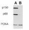 Chromatin assembly factor 1 subunit B antibody, NB500-212, Novus Biologicals, Western Blot image 