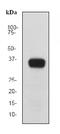 Kallikrein Related Peptidase 3 antibody, ab76113, Abcam, Western Blot image 
