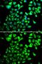 Single-stranded DNA-binding protein, mitochondrial antibody, GTX55806, GeneTex, Immunofluorescence image 