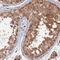 Protein Phosphatase 2 Regulatory Subunit B''Gamma antibody, HPA040835, Atlas Antibodies, Immunohistochemistry frozen image 