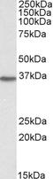 Dimethylarginine Dimethylaminohydrolase 1 antibody, STJ70103, St John