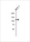 Rhomboid 5 Homolog 2 antibody, LS-C162586, Lifespan Biosciences, Western Blot image 