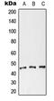 CXADR Ig-Like Cell Adhesion Molecule antibody, GTX56276, GeneTex, Western Blot image 