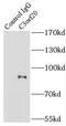 Chromosome 3 Open Reading Frame 20 antibody, FNab01105, FineTest, Immunoprecipitation image 