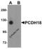 Protocadherin-18 antibody, 5081, ProSci Inc, Western Blot image 