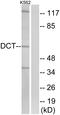 Dopachrome Tautomerase antibody, A30734, Boster Biological Technology, Western Blot image 