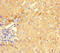 Guanosine Monophosphate Reductase antibody, LS-C318320, Lifespan Biosciences, Immunohistochemistry paraffin image 