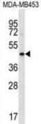 Hyaluronan And Proteoglycan Link Protein 3 antibody, abx029003, Abbexa, Western Blot image 