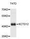 Potassium Channel Tetramerization Domain Containing 12 antibody, STJ27102, St John