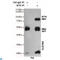 Bruton Tyrosine Kinase antibody, LS-C812898, Lifespan Biosciences, Immunoprecipitation image 