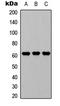 Gamma-Glutamyltransferase 1 antibody, LS-C354315, Lifespan Biosciences, Western Blot image 